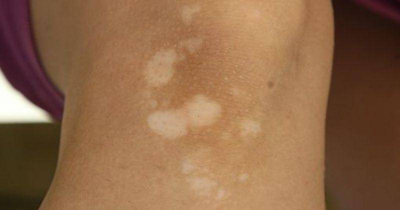 Pinterest.com/BelMarraHealth